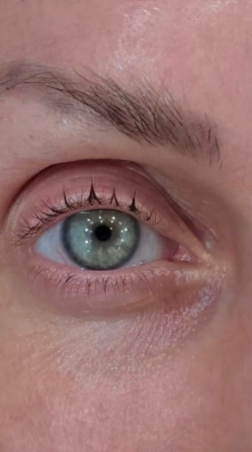 Cindy D.'s eye before using Long Lash Growth Serum