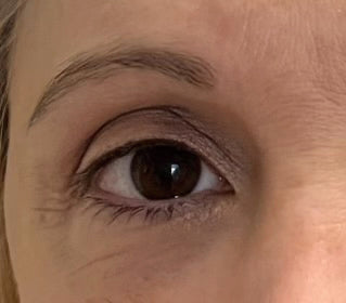 Jennifer K.'s eye before using Long Lash Growth Serum